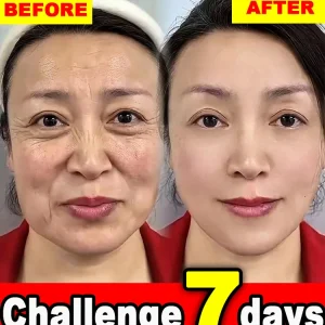 Wrinkles disappear,20 years younger
